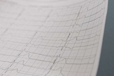 Neurofeedback 101